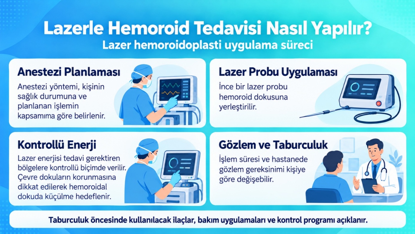 Lazerle hemoroid tedavisi nasıl yapılır: anestezi planlaması, lazer probu uygulaması, kontrollü enerji, gözlem ve taburculuk